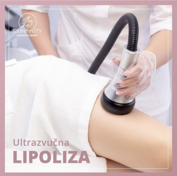 Lipoliza